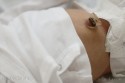 Umbilical Cord Stump